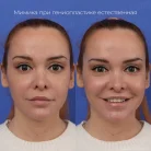 Клиника пластической хирургии Доктора Гурьянова Фотография 13