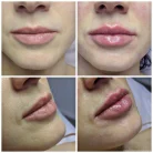 Клиника эстетической и медицинской косметологии Beauty vita Фотография 5