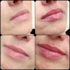 Клиника эстетической и медицинской косметологии Beauty vita Фотография 1