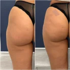 Центр здоровья и красоты Элефант Фотография 16