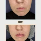 Клиника антиэйджинга Juvenis Фотография 16