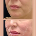 Клиника антиэйджинга Juvenis Фотография 10