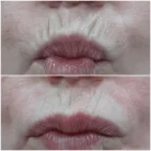 Клиника антиэйджинга Juvenis Фотография 11