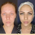 Клиника антиэйджинга Juvenis Фотография 9