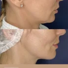 Клиника антиэйджинга Juvenis Фотография 17